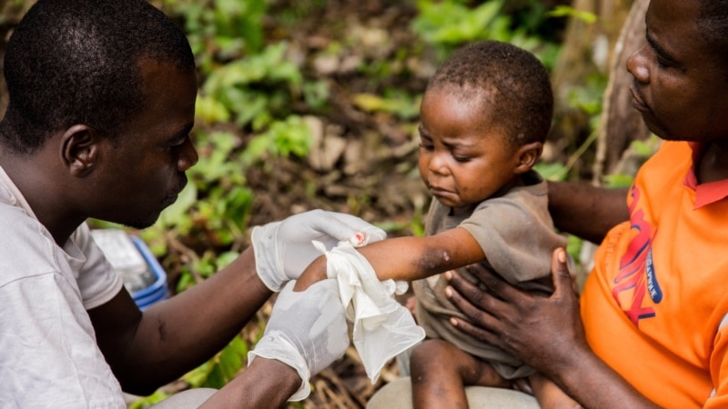 Mpox en RDC: 581 décès depuis janvier, nombre de cas record sur une année