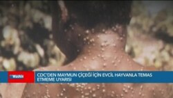 CDC Maymun Çiçeği Kılavuzunu Yeniledi