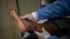 ILUSTRASI - Seorang dokter memeriksa luka pasien akibat terinfeksi cacar monyet (mpox) di ruang isolasi RS Arzobispo Loayza, Lima, 16 Agustus 2022. (AFP/Ernesto BENAVIDES)