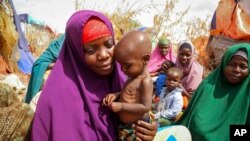 FILE - Nunay Mohamed, 25, who fled the drought-stricken Lower Shabelle area, holds her 1-year-old malnourished child at a makeshift camp for the displaced near Mogadishu, Somalia, June 30, 2022.