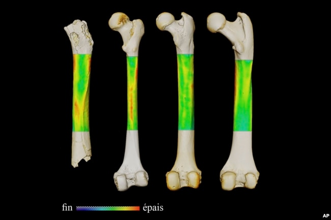 This photo provided by the University of Poitiers in August 2022 shows an example of analysis performed to work out how Sahelanthropus tchadensis moved. From left are the femurs of Sahelanthropus tchadensis, a modern human, a chimpanzee and a gorilla. (Franck Guy/PALEVOPRIM/CNRS – Universite de Poitiers via AP)