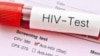Gwajin HIV/AIDS