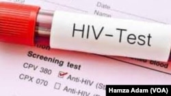 Gwajin HIV/AIDS