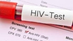 Gwajin HIV/AIDS