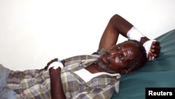 A victim of the Tana River clashes between the pastoralists and farmers within the delta region rests inside a ward at the Malindi District hospital in Kenya, September 7, 2012.