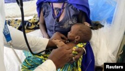 Aisha Usman, a 14-month-old malnourished child, receives treatment at a stabilization center in Damaturu, Yobe, Nigeria, Aug. 24, 2022.