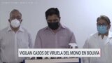 Vigilancia epidemiológica en Bolivia 