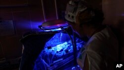 Doktorica Tatjana Mirošnjičenko u neonatalnoj bolnici Pokrovsk pregleda Veroniku, bebu koja je rođena skoro dva mjeseca prije vremena, 15. augusts u regionu Donjecka.