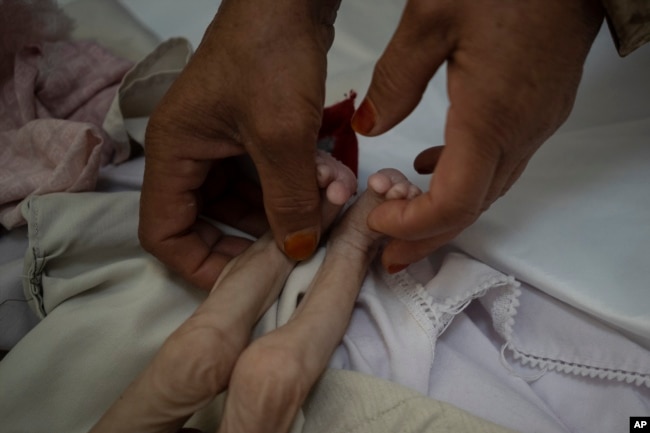 Ibu tiri Mohammed, 4 bulan, yang kekurangan gizi, memegang kakinya di rumah sakit Indira Gandhi di Kabul, Afghanistan, 8 November 2021. (Foto: AP)