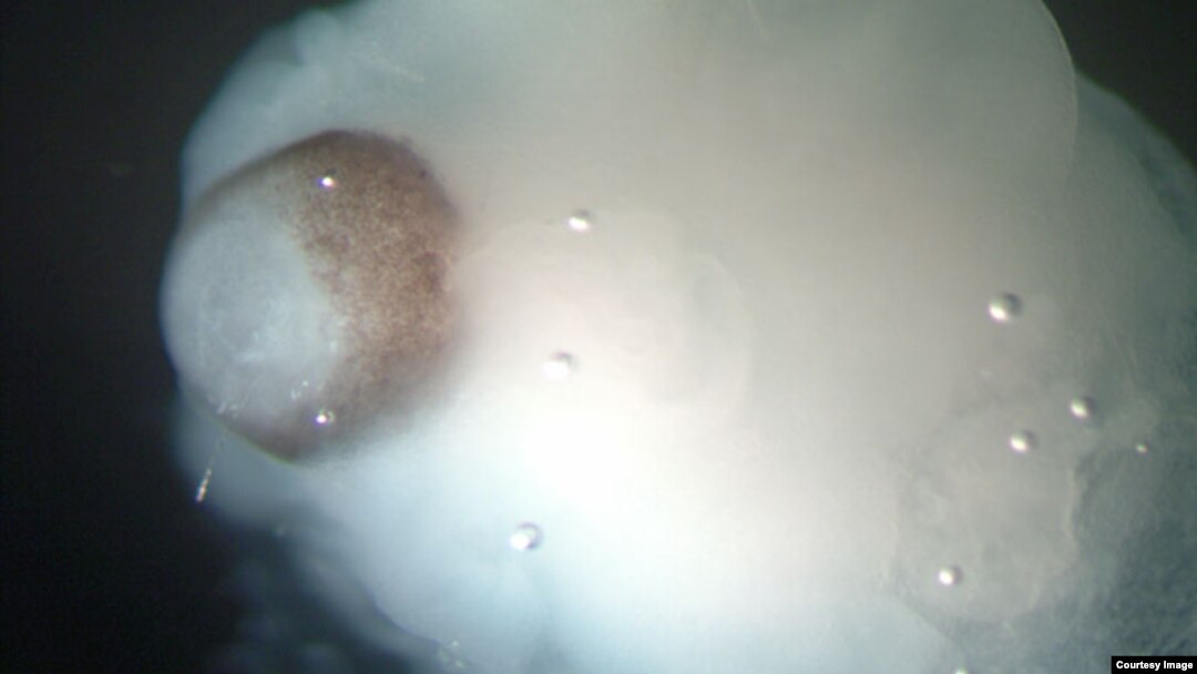 A magnified image of a cerebral organoid showing cerebral tissue adjacent to developing retinal tissue (brown pigmented region). (Credit: Madeline A. Lancaster)