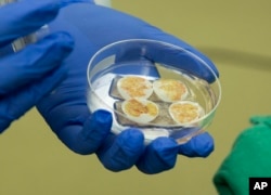 FILE - Thymus tissue was used for a transplant to a pediatric heart patient at Duke University Hospital in Durham, N.C., on Aug. 16, 2021. Duke University doctors say the baby is thriving after a first-of-its-kind heart transplant.