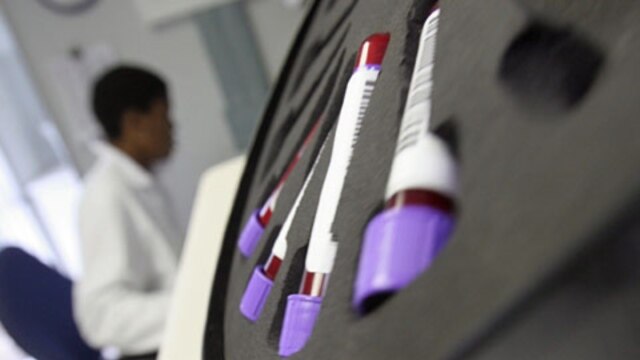 HIV/AIDS - PEPFAR Success - August 13, 2021