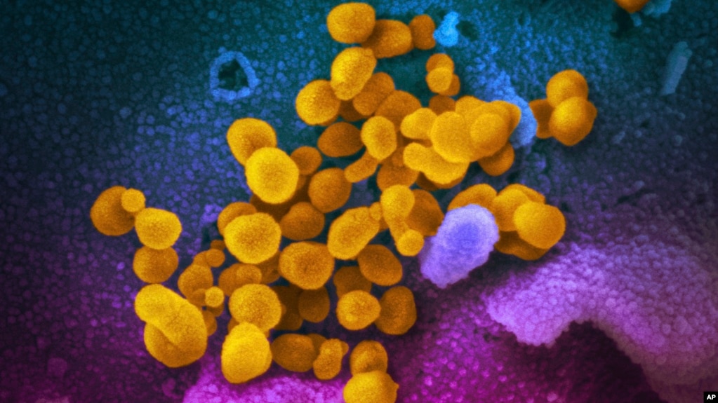 This undated, colorized electron microscope image made available by the U.S. National Institutes of Health in February 2020 shows SARS-CoV-2, indicated in yellow, emerging from the surface of cells, indicated in blue/pink, cultured in the lab. (NIAID-RML via AP, File)