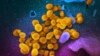 A colorized electron microscope image made available by the U.S. National Institutes of Health in February 2020 shows the novel Coronavirus SARS-CoV-2, indicated in yellow, cultured in the lab. (NIAID-RML/AP)