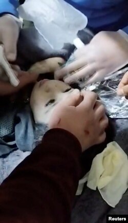 در سوریه امدادگران این کودک را نجات دادند ولی اعضای خانواده او همه کشته شدند.