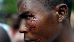 Restraint Needed to Prevent Further Violence in Burundi