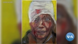 Face of Olena Kurilo – Bloodied Symbol of Russia’s Attack on Ukraine
