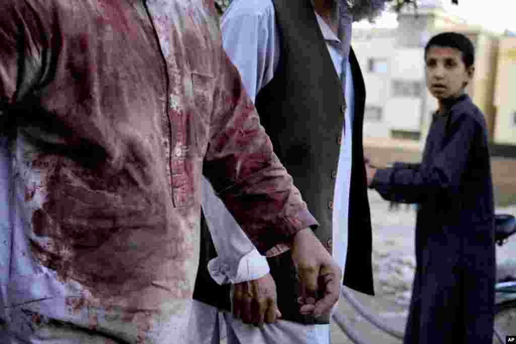 An Afghan blood-stained worshiper walks around the mosque where the explosion took place, in Kabul, Afghanistan. 
