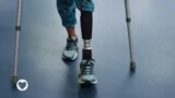 Saúde em Foco: Os desafios das pessoas com deficiência no trabalho