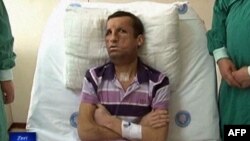 Transplantimi i parë i fytyrës në Turqi