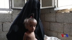 Xalqaro hayot - 8-yanvar, 2019-yil - Yaman urushi gumanitar ofatni keskinlashtirmoqda