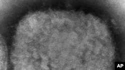 Esta imagen de microscopio electrónico de 2003 proporcionada por los Centros para el Control y la Prevención de Enfermedades muestra un virión de viruela del mono, obtenido de una muestra asociada con el brote de perros de las praderas de 2003.