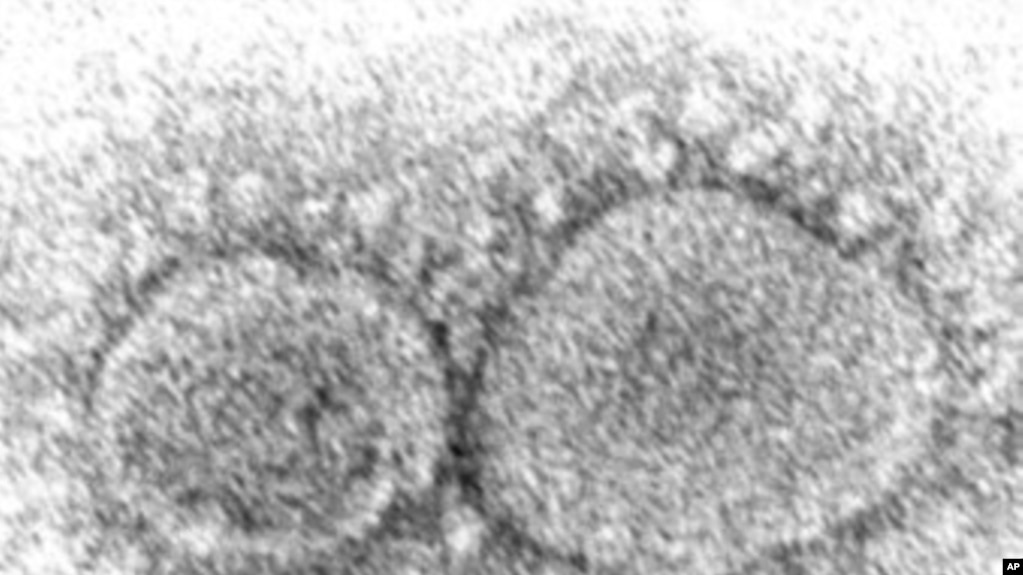 FILE - This 2020 electron microscope image made available by the Centers for Disease Control and Prevention shows SARS-CoV-2 virus particles which cause COVID-19.