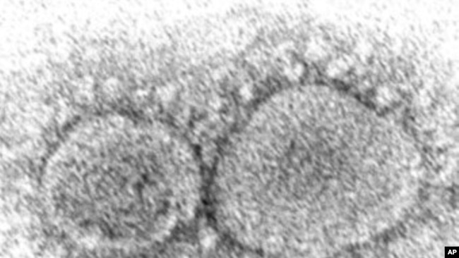 Pamje me mikroskop elektronik të virusit SARS-CoV-2