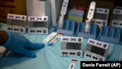 Petugas laboratorium menguji sampel darah untuk infeksi HIV di Reproductive Health and HIV Institute (RHI) di Johannesburg. (Foto: AP/Denis Farrell)