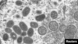 FOTO DE ARCHIVO: Una imagen microscópica electrónica (EM) muestra partículas maduras del virus de la viruela del simio de forma ovalada, obtenidas de una muestra clínica de piel humana asociada con el brote de perros de las praderas de 2003 obtenida por Reuters el 18 de mayo de 2022. Cynthia S. Goldsmith, Russell Regnery/CDC/Foto de archivo