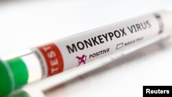 Test tube labelled "Monkeypox virus positive" are seen in this illustration taken May 22, 2022.