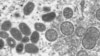 Mikroskopski prikaz virusa koji izaziva majmunske boginje (Foto: AP/Cynthia S. Goldsmith, Russell Regner/CDC)