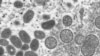 Në këtë imazh në mikroskop duket virusi i pjekur me forma ovale i lisë së majmunit