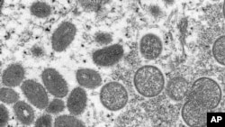 This 2003 electron microscope image made available by the Centers for Disease Control and Prevention shows mature, oval-shaped monkeypox virus. European and American health officials have identified several cases of monkeypox outside of Africa recently. 