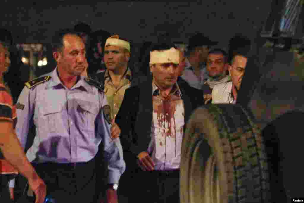 Macedonian police escorts injured members of the parliament including Social Democratic leader Zoran Zaev near the parliament in Skopje. Macedonia, April 27, 2017. 