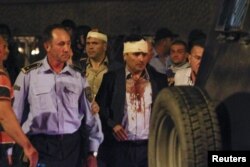 Macedonian police escorts injured members of the parliament including Social Democratic leader Zoran Zaev near the parliament in Skopje. Macedonia, April 27, 2017.