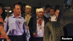 Macedonian police escorts injured members of the parliament including Social Democratic leader Zoran Zaev near the parliament in Skopje. Macedonia, April 27, 2017. 