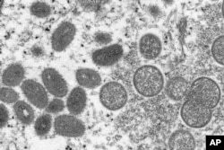 Imagen de un microscopio electrónico proporcionada el miércoles 18 de mayo de 2022 por los Centros para el Control y Prevención de Enfermedades (CDC) de EEUU muestra viriones maduros de viruela del mono, de forma ovalada (izquierda) y viriones inmaduros esféricos (derecha), obtenidos de una muestra de piel humana asociada con un brote de 2003. Foto divulgada por AP.