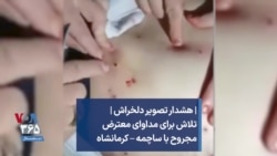 | هشدار تصویر دلخراش | تلاش برای مداوای معترض مجروح با ساچمه – کرمانشاه