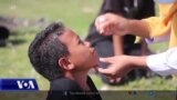 Indonezi, fushata e imunizimit ndaj poliomielitit dhe dezinformimi