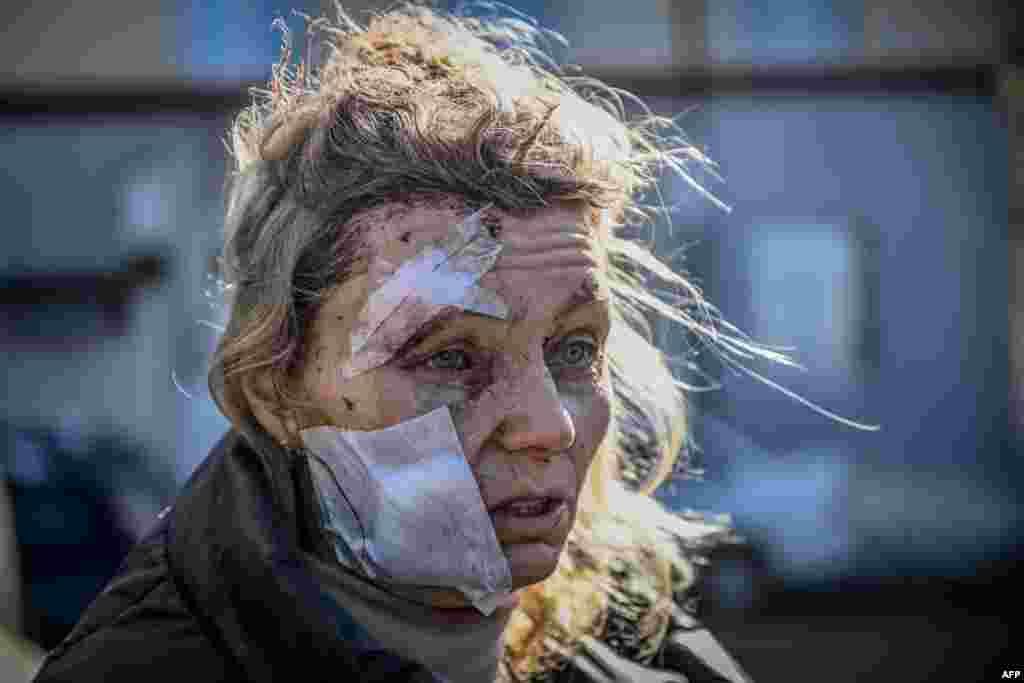 Helena, a 53-year-old teacher, stands outside a hospital after the bombing of the eastern Ukraine town of Chuguiv, Ukraine, Feb. 24, 2022, as Russian armed forces attempt to invade Ukraine from several directions, using rocket systems and helicopters to attack&nbsp;Ukrainian position in the south, the border guard service said.