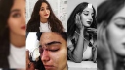 غزل رنجکش بینایی چشم راستش را بر اثر اصابت گلوله ساچمه‌ای از دست داد (عکس از صفحه اینستاگرام غزل رنجکش)