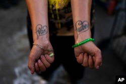 FILE - Jennifer Catano, a 27-year-old fentanyl addict, shows tattoos of the names of her two children, Evan and Audrey, in Los Angeles, Aug. 23, 2022.