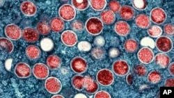 FILE - This image provided by the National Institute of Allergy and Infectious Diseases (NIAID) shows a colorized transmission electron micrograph of monkeypox particles (red) found within an infected cell (blue).