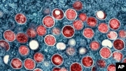 FILE - This image provided by the National Institute of Allergy and Infectious Diseases shows a colorized transmission electron micrograph of mpox particles (red) found within an infected cell (blue).