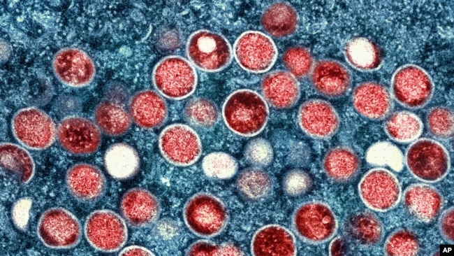 FILE - This image provided by the National Institute of Allergy and Infectious Diseases shows a colorized transmission electron micrograph of mpox particles (red) found within an infected cell (blue).