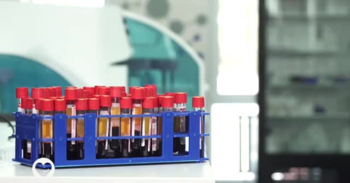Tackling Sickle Cell Disease