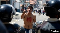 A boy with blood on his chest and hand gestures in front of police after 14-year-old student Kluiver Roa died during a protest in San Cristobal, Feb. 24, 2015.