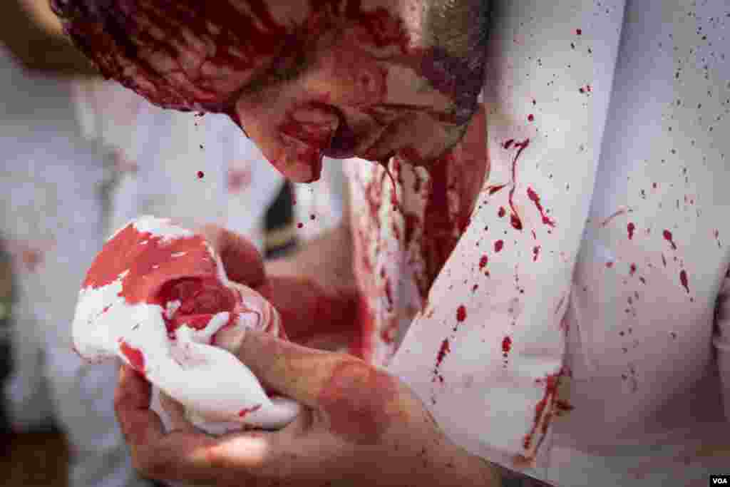 Often done with a knife stroke to the head, the act of bloodletting is called tatbir. (J. Owens/VOA)
