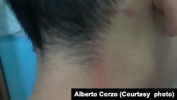 Lesiones sufridas por el hijo de Alberto Corzo, Raidel, quien fue atacado por niños.  Corzo dijo que un maestro y adultos animaron a los niños a atacar a su hijo.